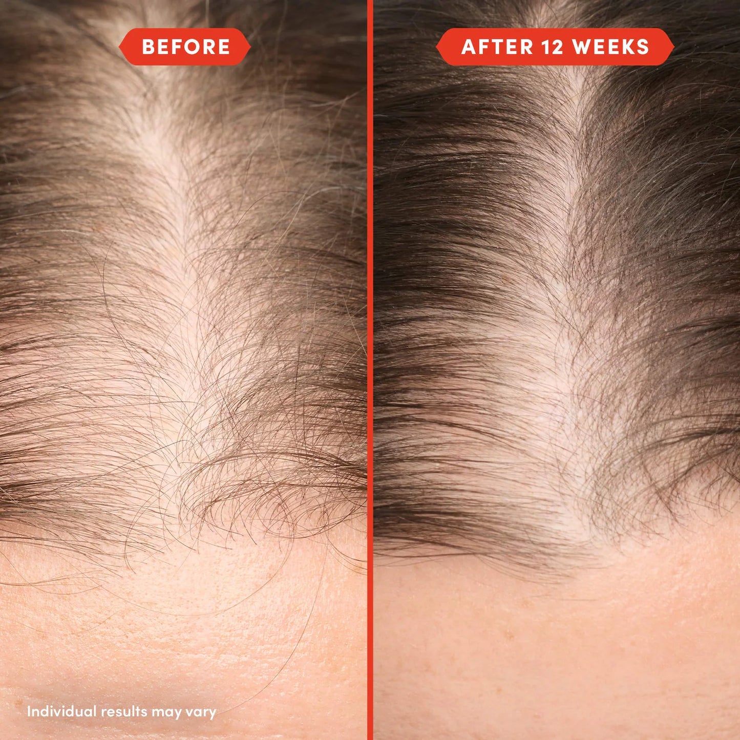 Fable & Mane 
Mini HoliRoots™ Pre-Wash Treatment Oil for Thinning Hair