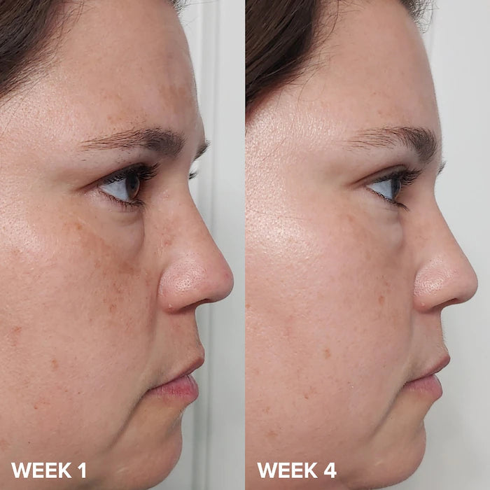 Paula's Choice 
Mini Skin Perfecting 2% BHA Liquid Exfoliant for Clear Skin