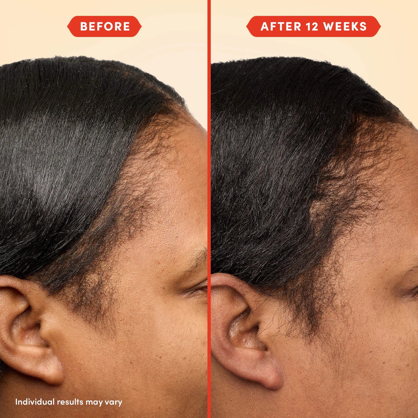 Fable & Mane 
Mini HoliRoots™ Pre-Wash Treatment Oil for Thinning Hair