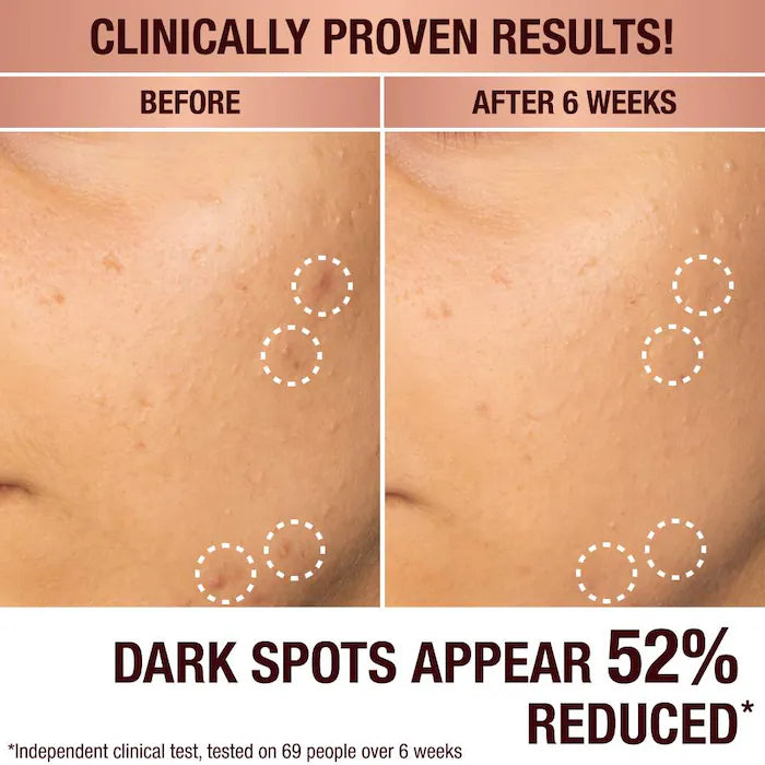 Charlotte Tilbury 
Dark Spot Correcting Radiance Recovery Serum With Vitamin C