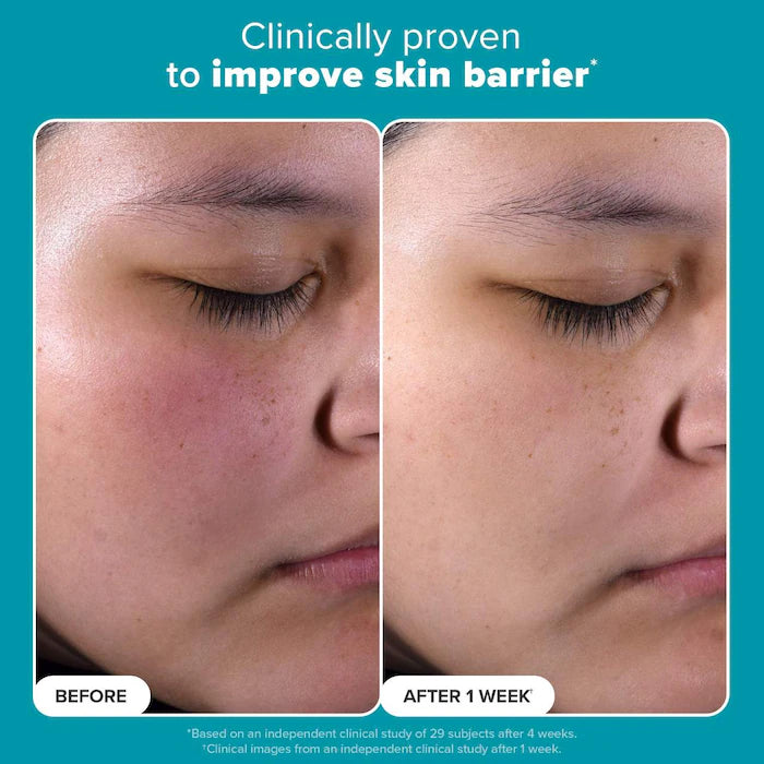 Paula's Choice 
Mini Skin Perfecting 2% BHA Liquid Exfoliant for Clear Skin