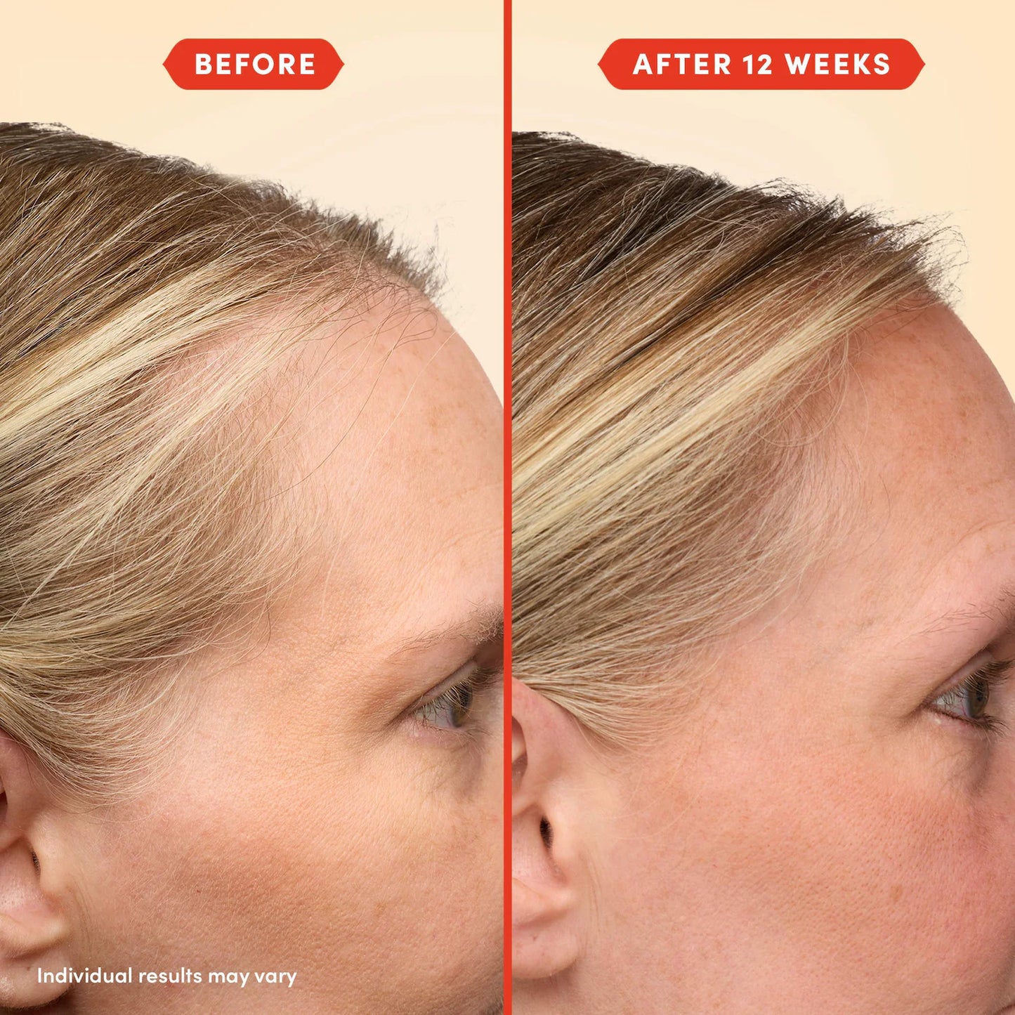 Fable & Mane 
Mini HoliRoots™ Pre-Wash Treatment Oil for Thinning Hair
